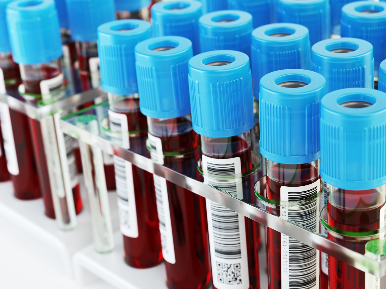 Vials of blood samples in a rack.