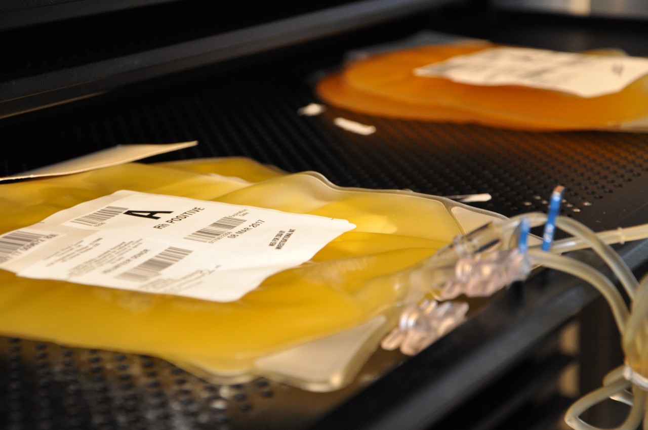 Yellow platelets in a blood bag after being collected from a donor