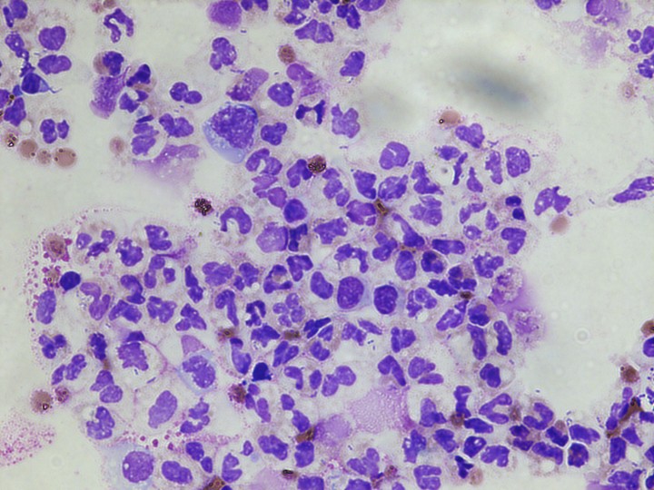 Menstrual fluid shown under a microscope